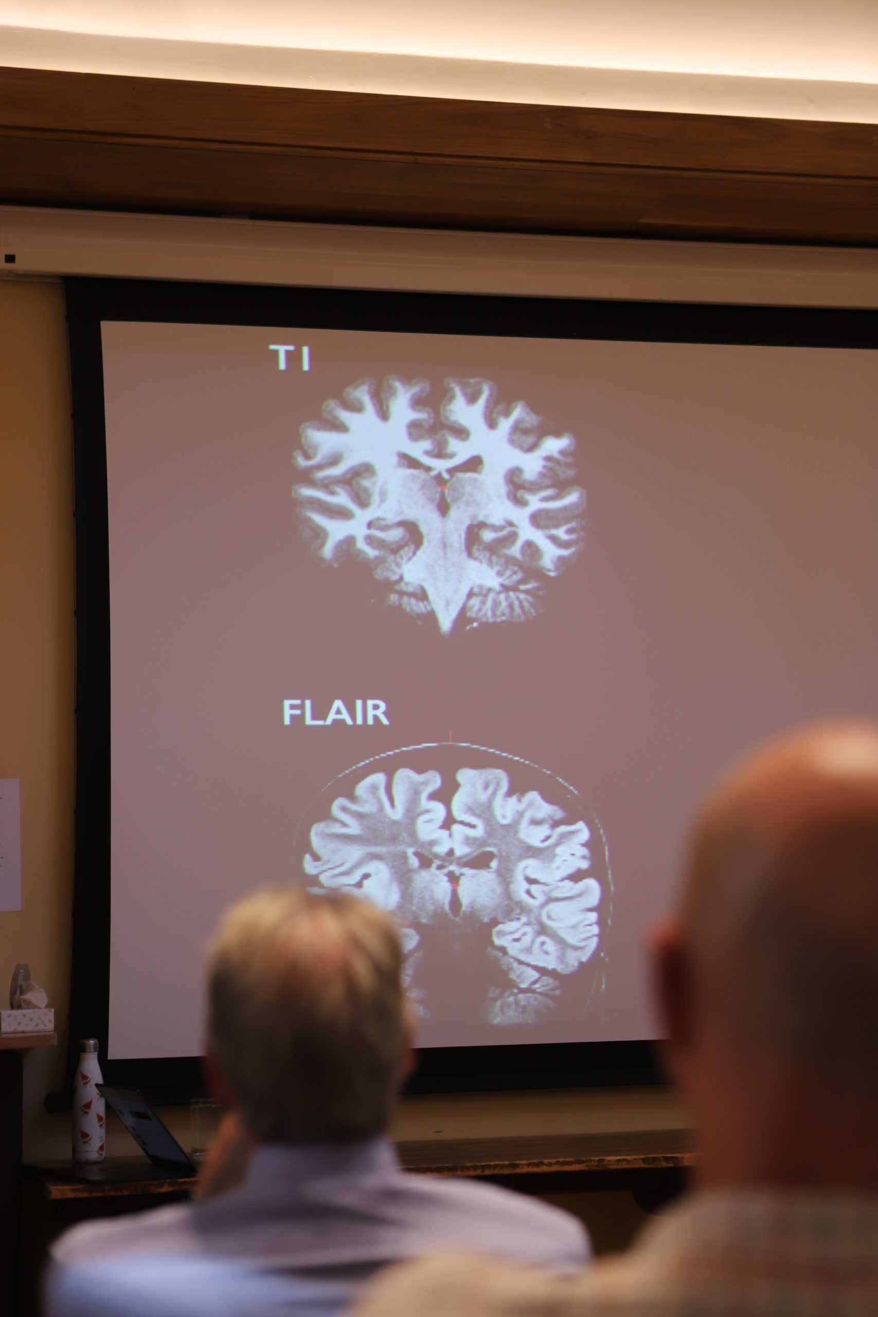 Brain scans on the screen, in silhouette